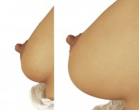 Voorbeeld: Borstcups voor gevoeligere en grotere borsten